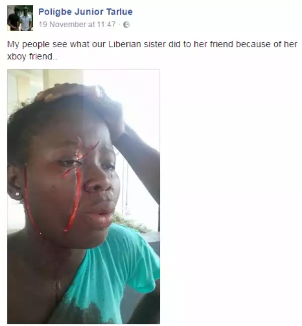 See what a Liberian girl allegedly did to her friend because of her ex-boyfriend